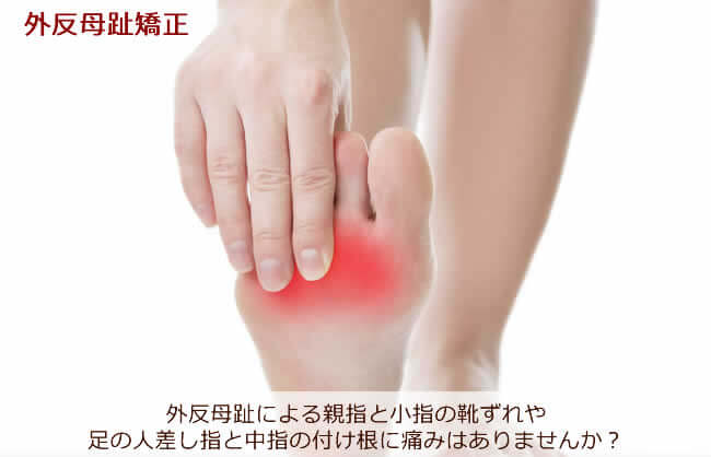 外反母趾による親指と小指の靴ずれや足の人差し指と中指の付け根に痛みはありませんか？